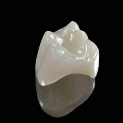 dentista roma Corone dentali Zirconio / Disilicato di litio (Metal Free)
