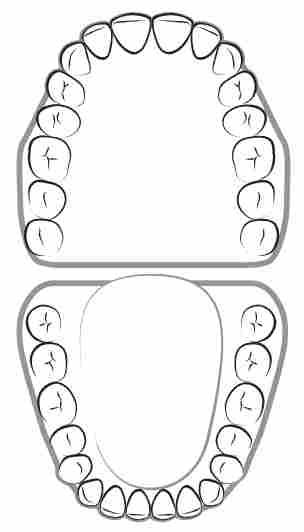 arcate dentali dentista roma 