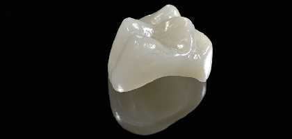 Capsula dentale roma