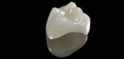 capsula dentale roma