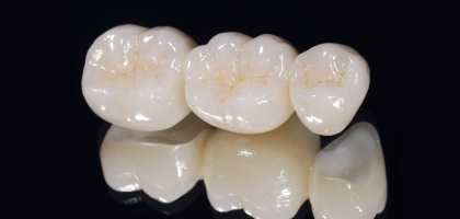 Corone dentali in Zirconio / Disilicato di Litio (Metal free)