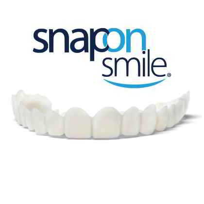dentista roma Snap On Smile